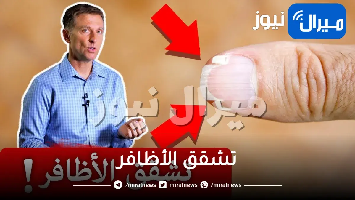 تشقق الأظافر .. ما هي الاسباب ما هو العلاج وهل من وقاية؟
