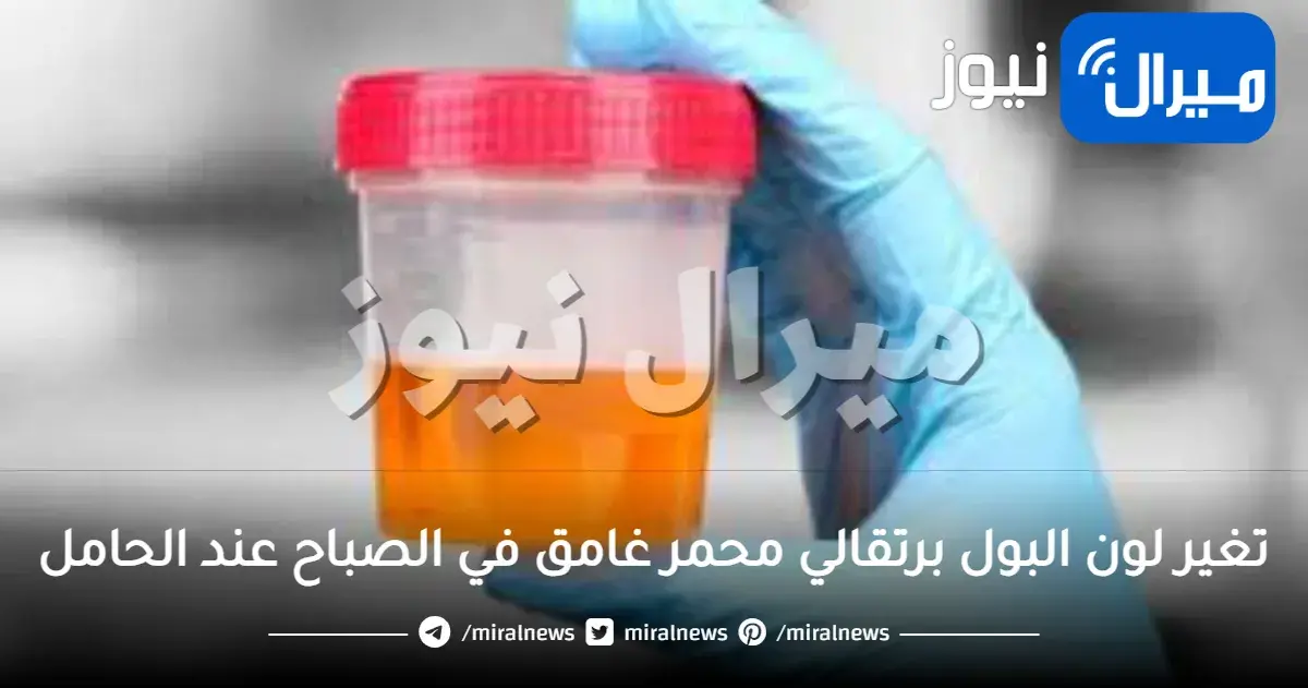 ما هو سبب تغير لون البول لبرتقالي محمر غامق في الصباح عند الحامل