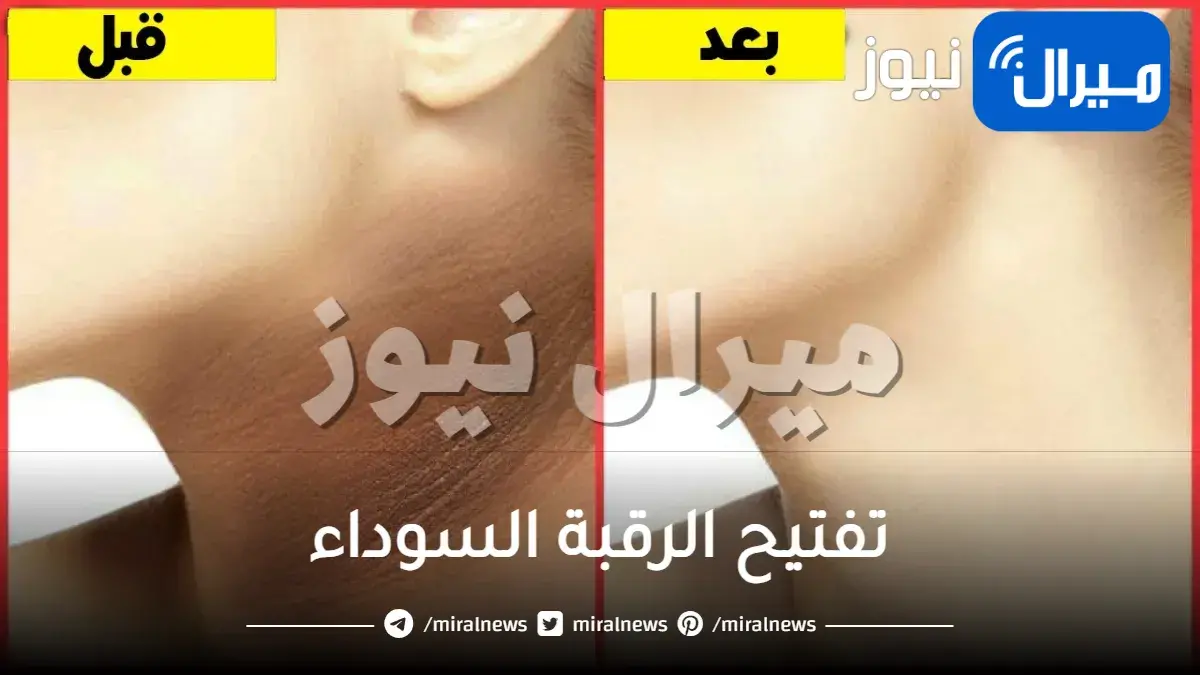 خلطات تفتيح الرقبة السوداء بسرعة