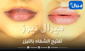 تفتيح الشفاه بالليزر