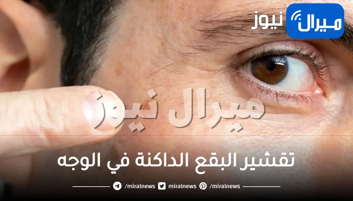 تقشير البقع الداكنة في الوجه