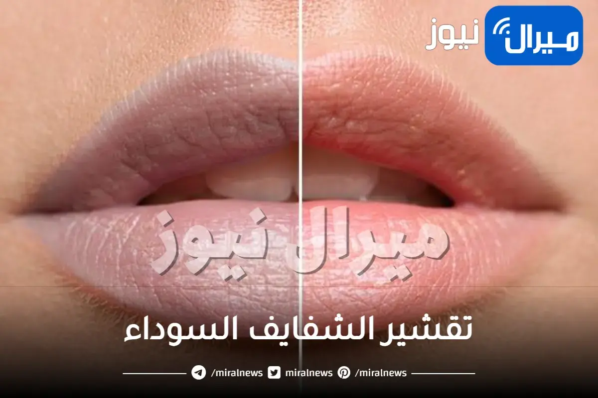 تقشير الشفايف السوداء