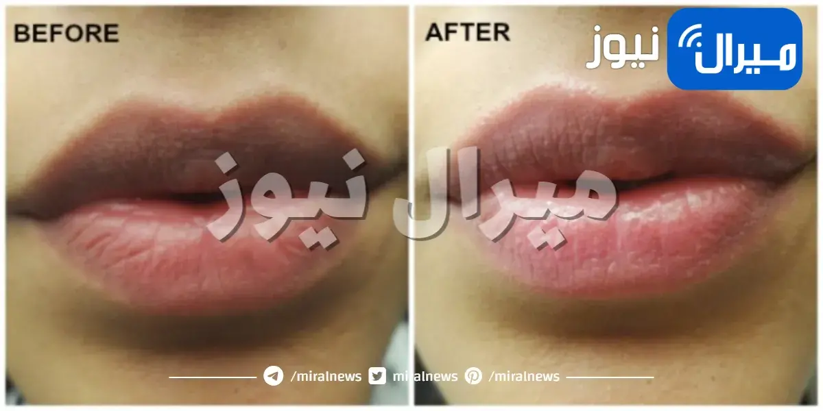 10 طرق مثبتة لتفتيح الشفاه الداكنة