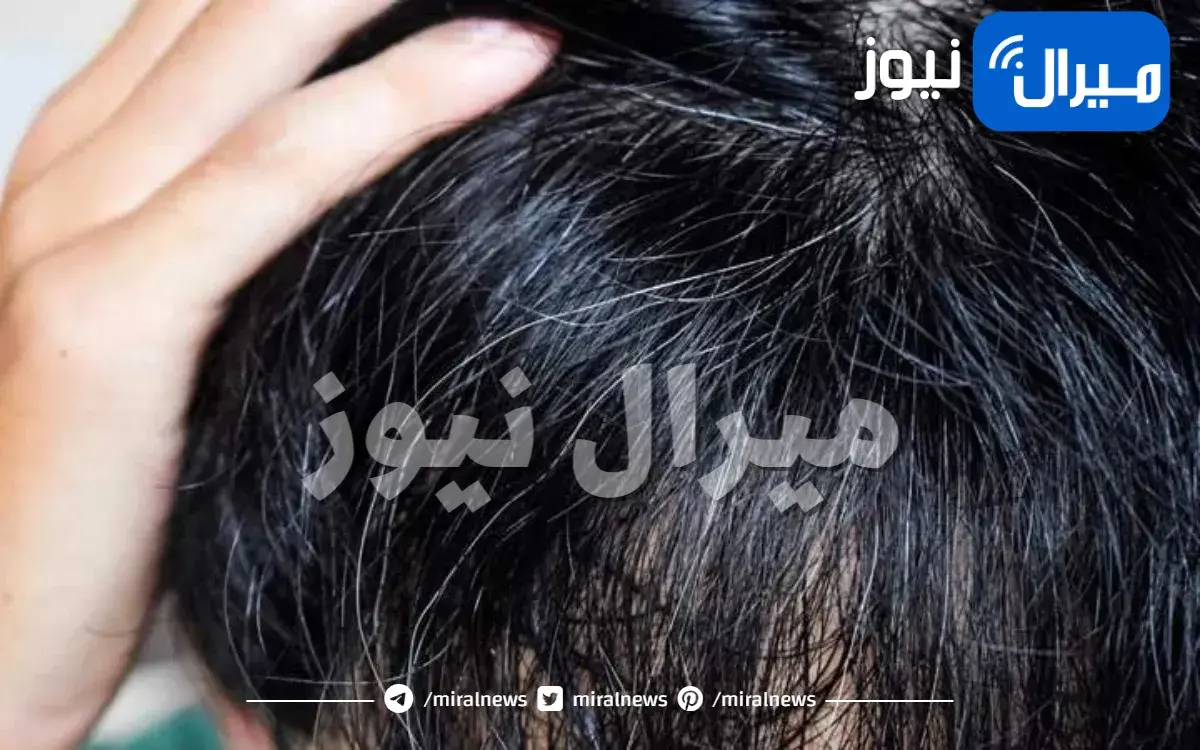 علاج الشيب المبكر نهائيا مجرب 3 وصفات