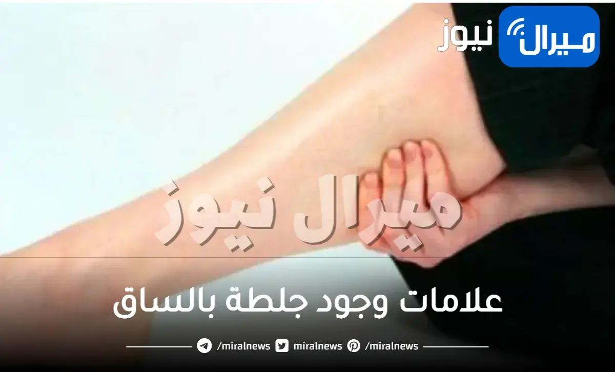 علامات وجود جلطة بالساق وشكلها وعلاجها وتجربتي مع جلطة الساق