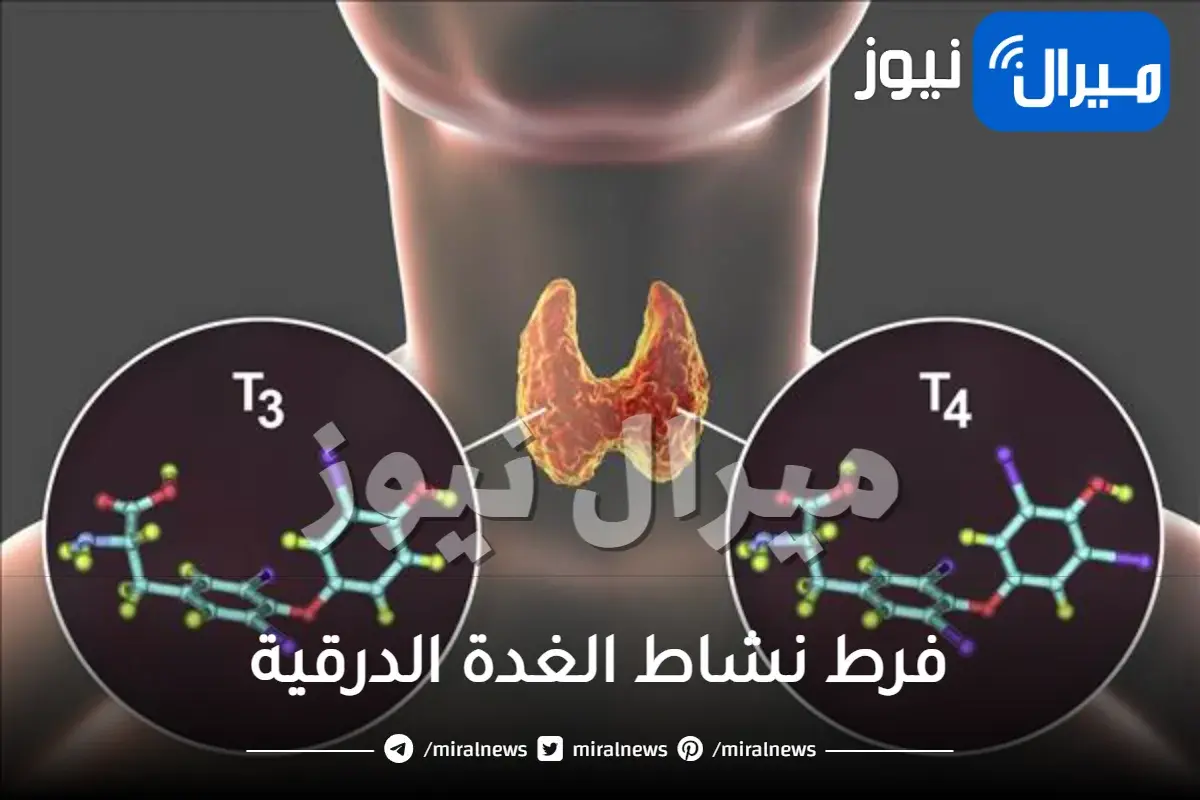 فرط نشاط الغدة الدرقية واعراضها و طرق علاجها المختلفة