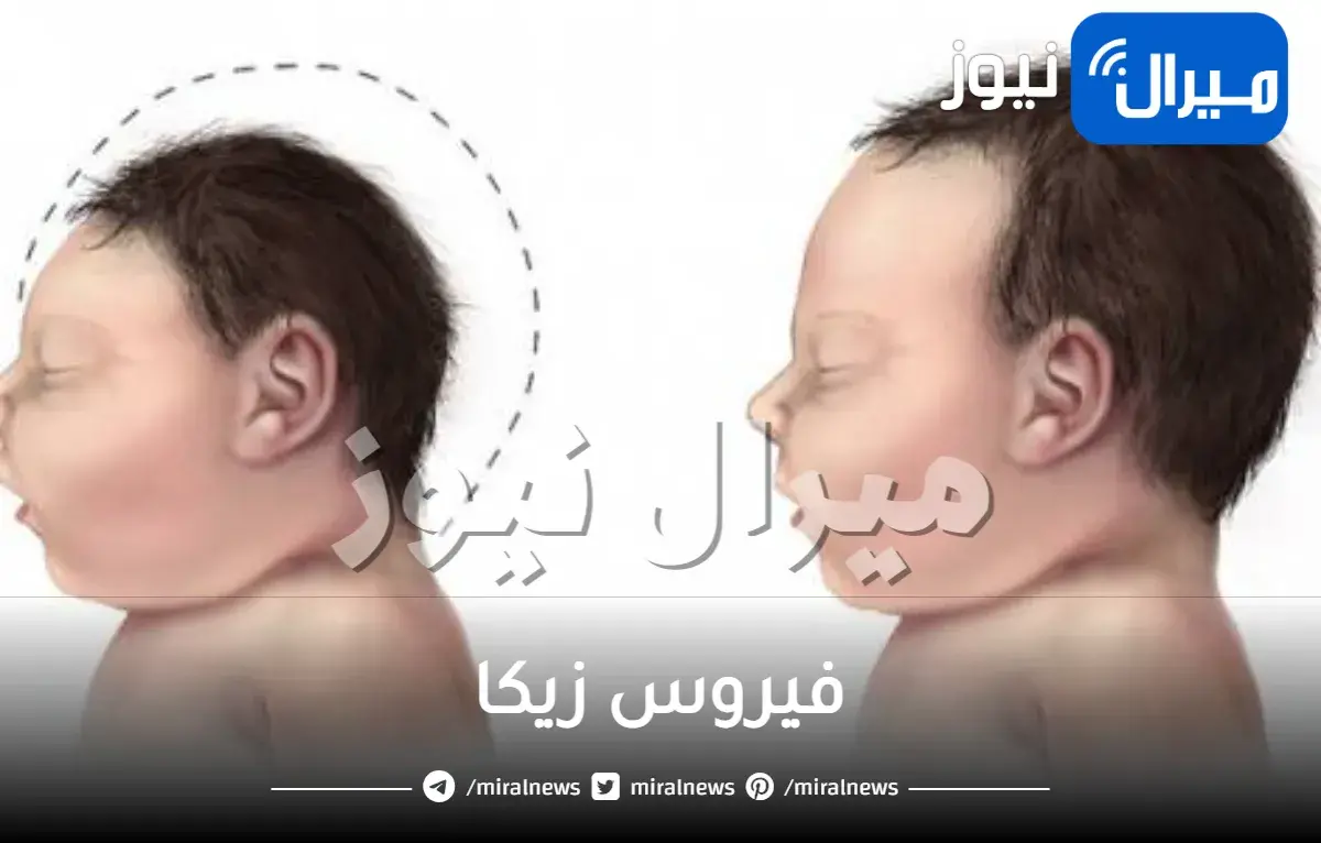 فيروس زيكا اسبابه واعراضه وخطورته للحامل