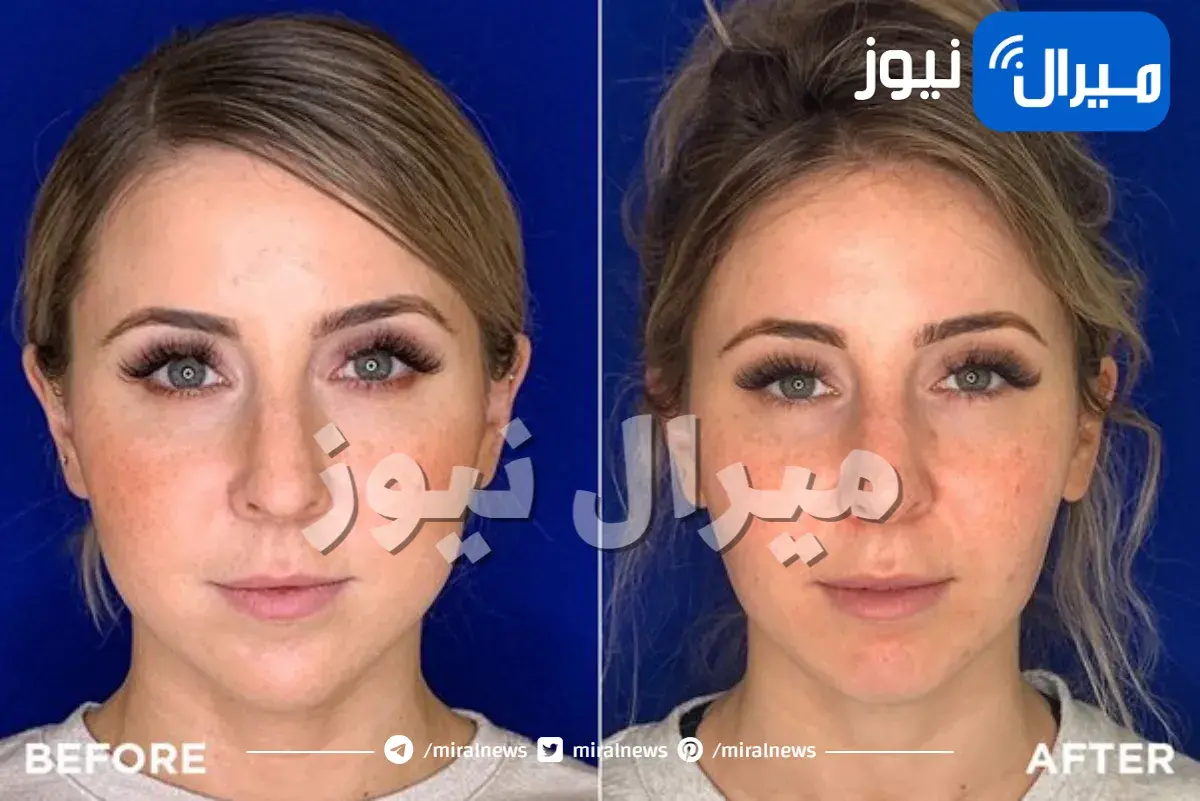 كيف اجعل وجهي سمين