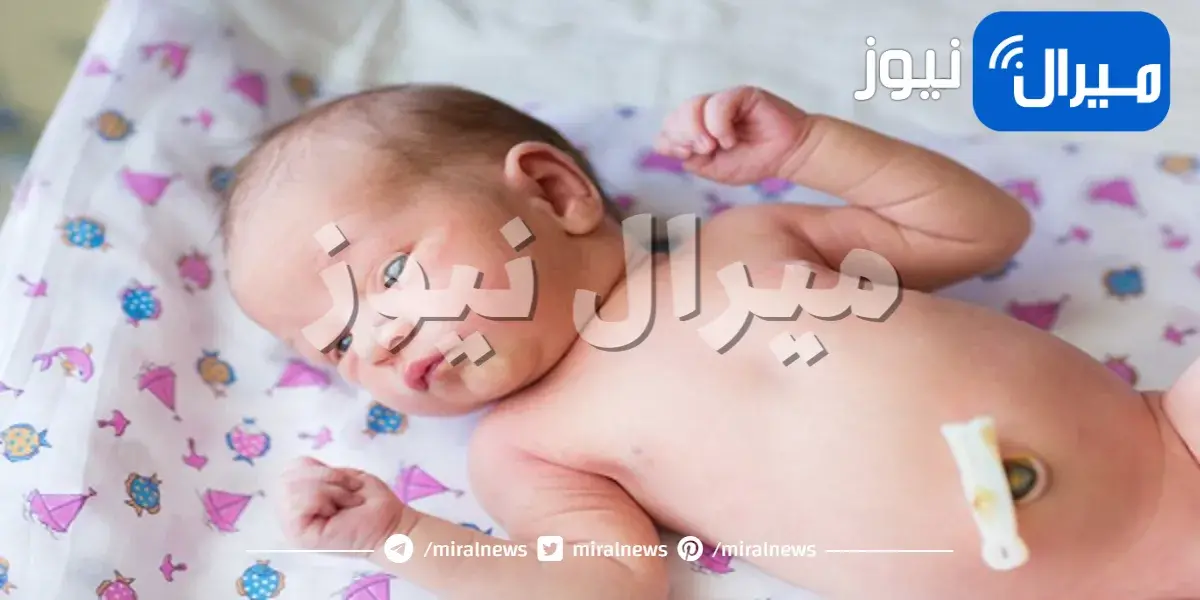 كيف تتعامل مع سرة الطفل حديث الولادة