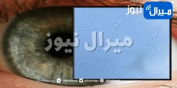 ما الذي يسبب عوائم العين أو ذبابة العين !