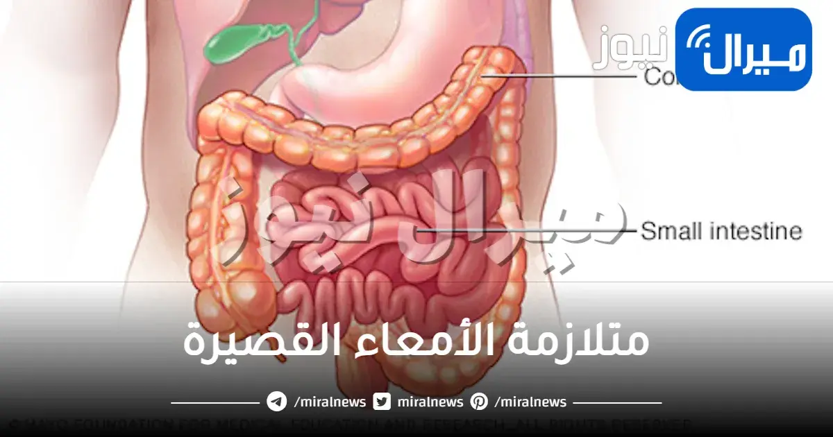 متلازمة الأمعاء القصيرة واعراضها واسبابها وعلاجها