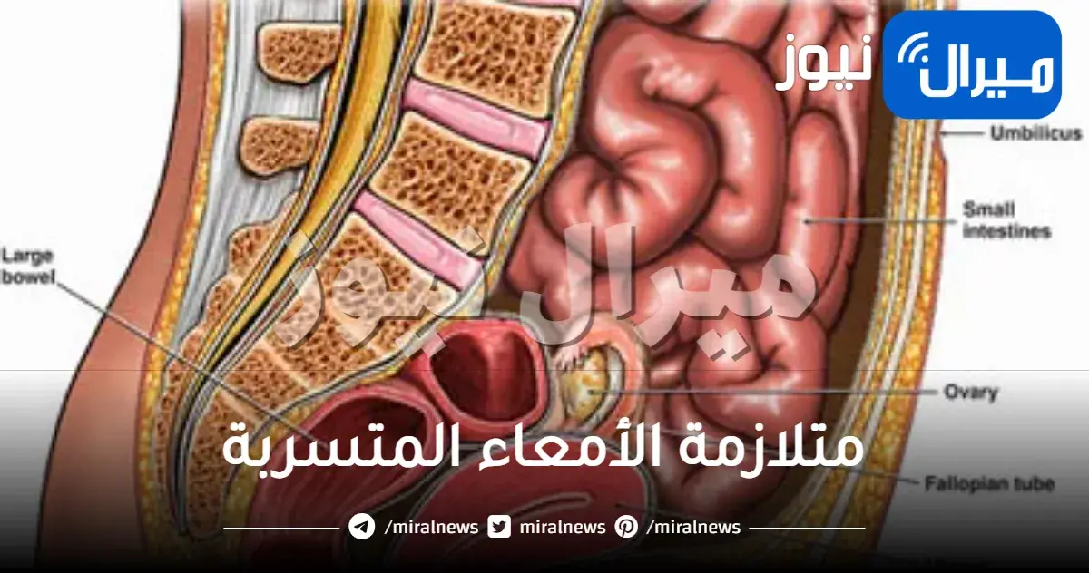 متلازمة الأمعاء المتسربة وأبرز المعلومات عنها