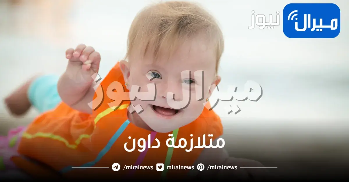 متلازمة داون