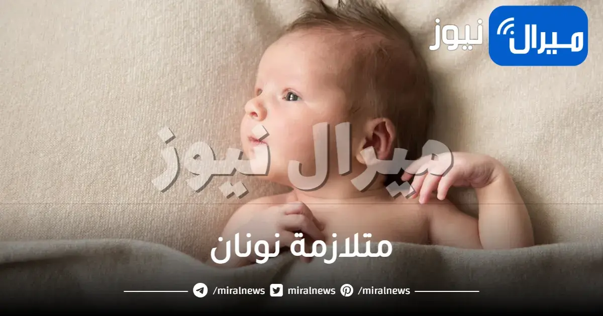 متلازمة نونان