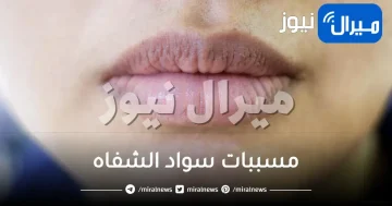 أكثر 10 مسببات لسواد الشفاه