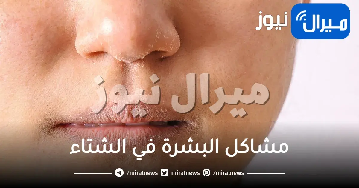 أهم مشاكل البشرة في الشتاء وطرق علاجها