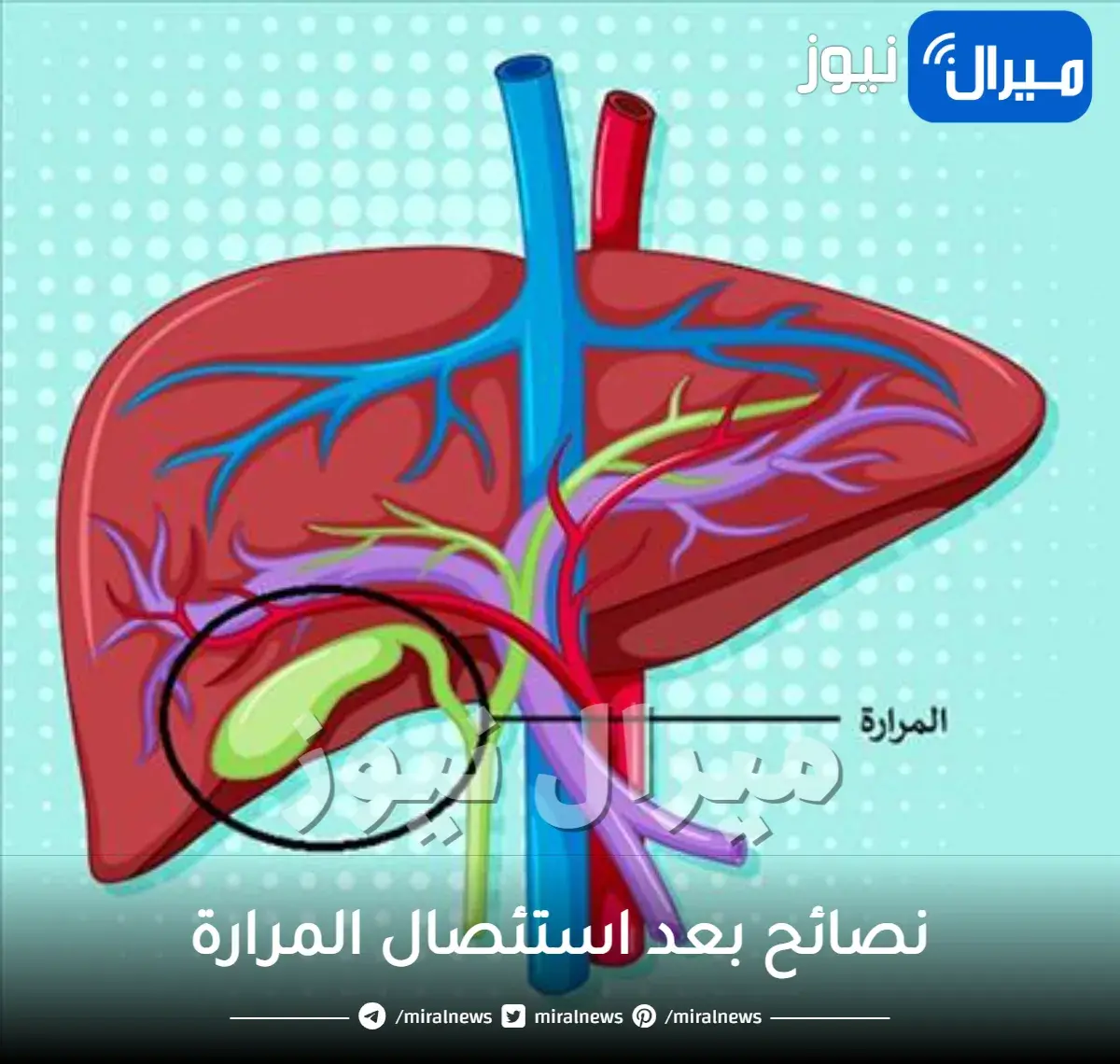نصائح بعد استئصال المرارة