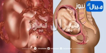 10 تغيرات تحدث للسيدة أثناء الحمل