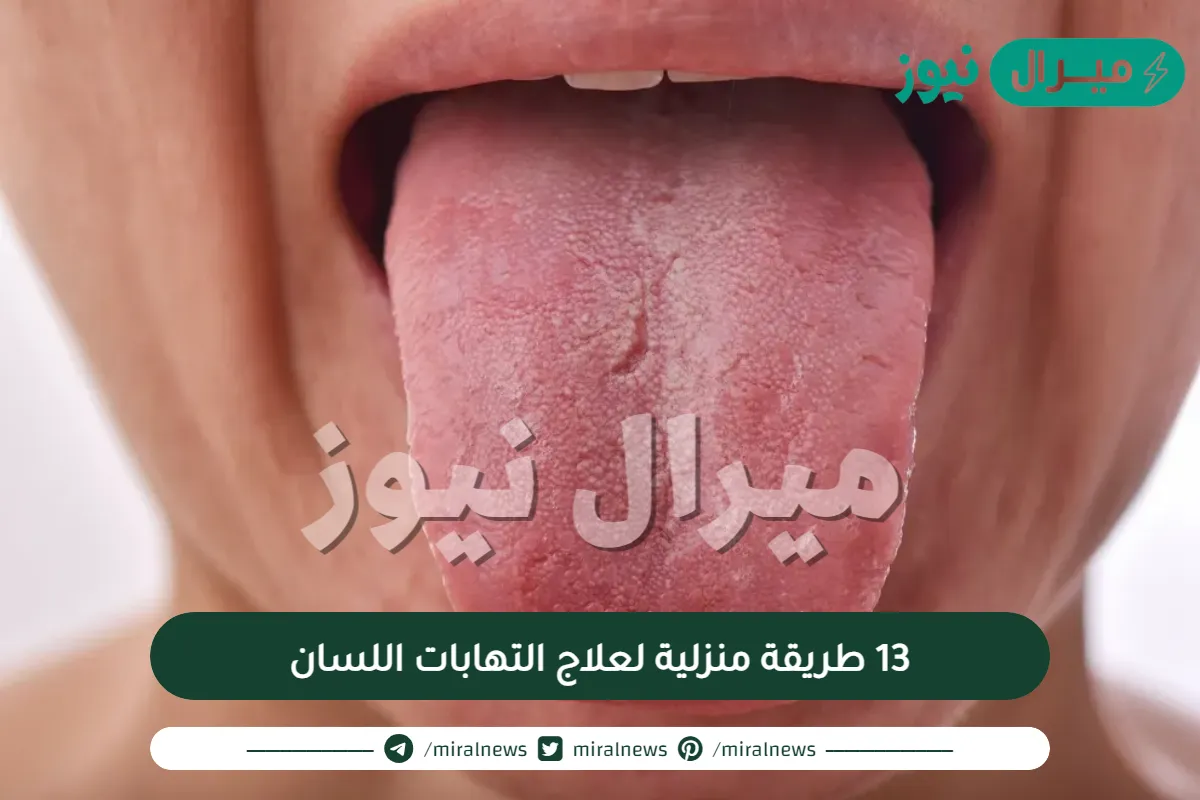 13 طريقة منزلية لعلاج التهابات اللسان