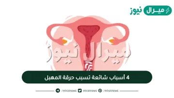 4 أسباب شائعة تسبب حرقة المهبل
