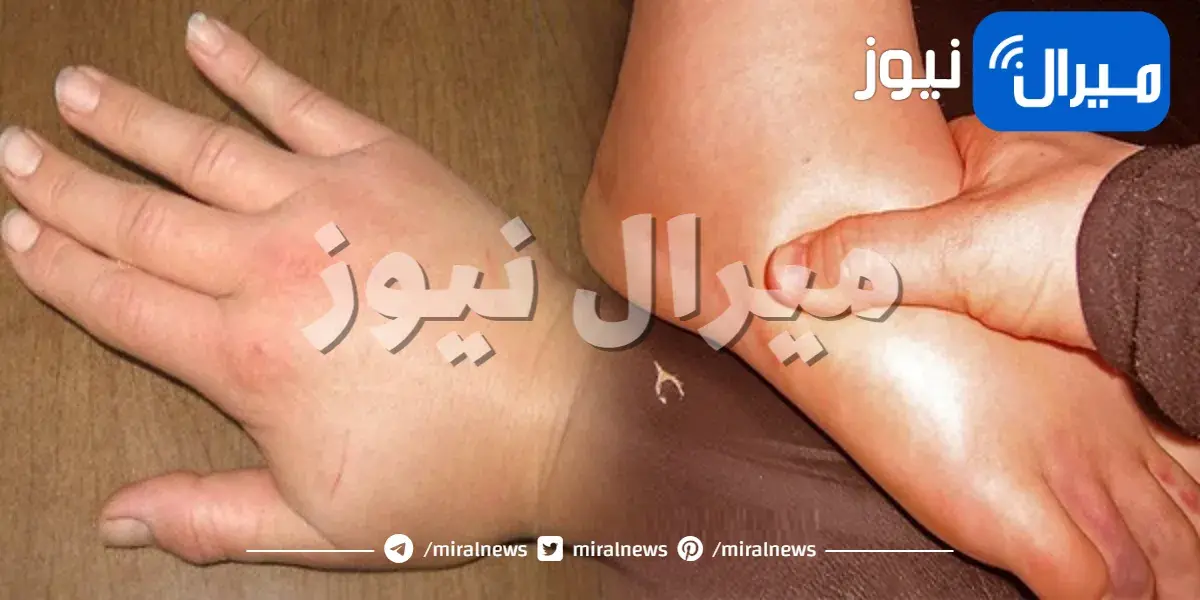 أبسط الطرق للتخلص من احتباس الماء بالجسم