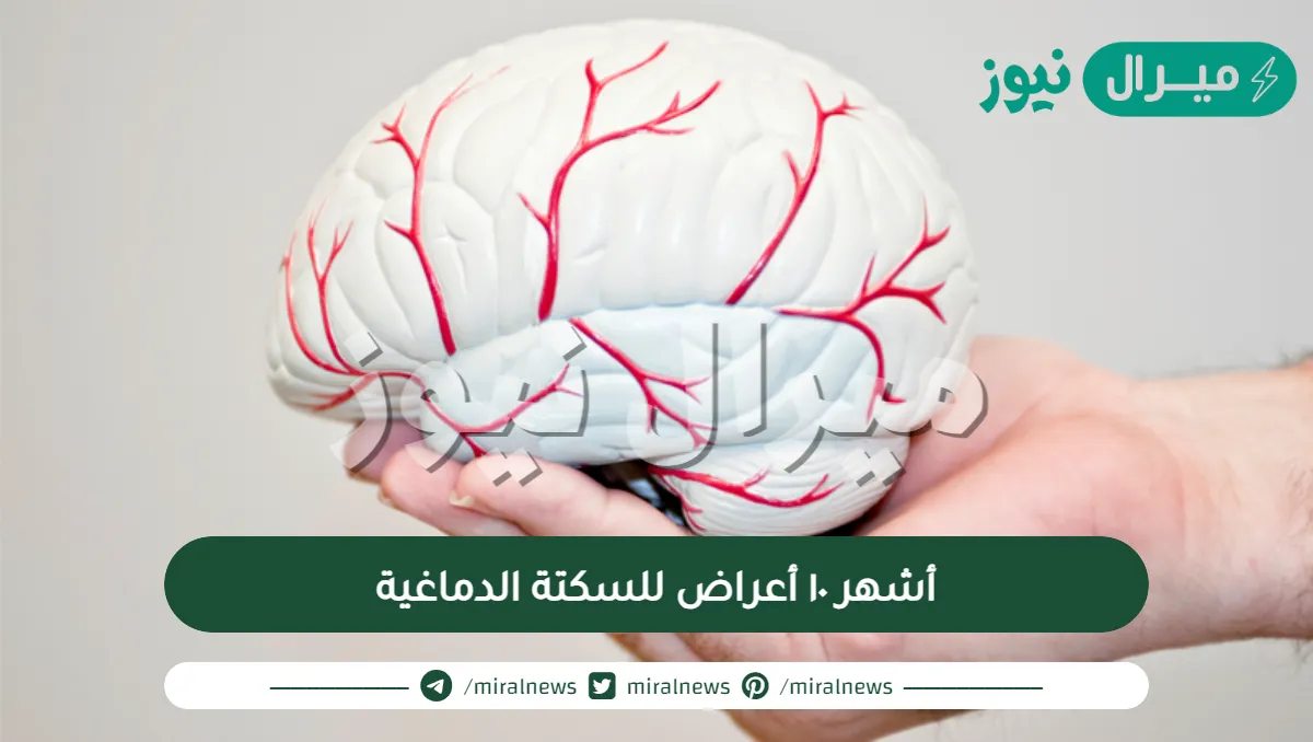 أشهر ١٠ أعراض للسكتة الدماغية