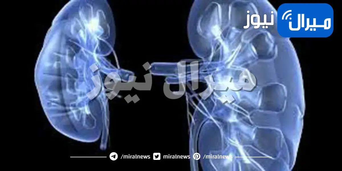 أطعمة لا يجب أن تتناولها عند الإصابة بحصوات الكلى