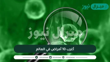 أغرب 10 أمراض في العالم