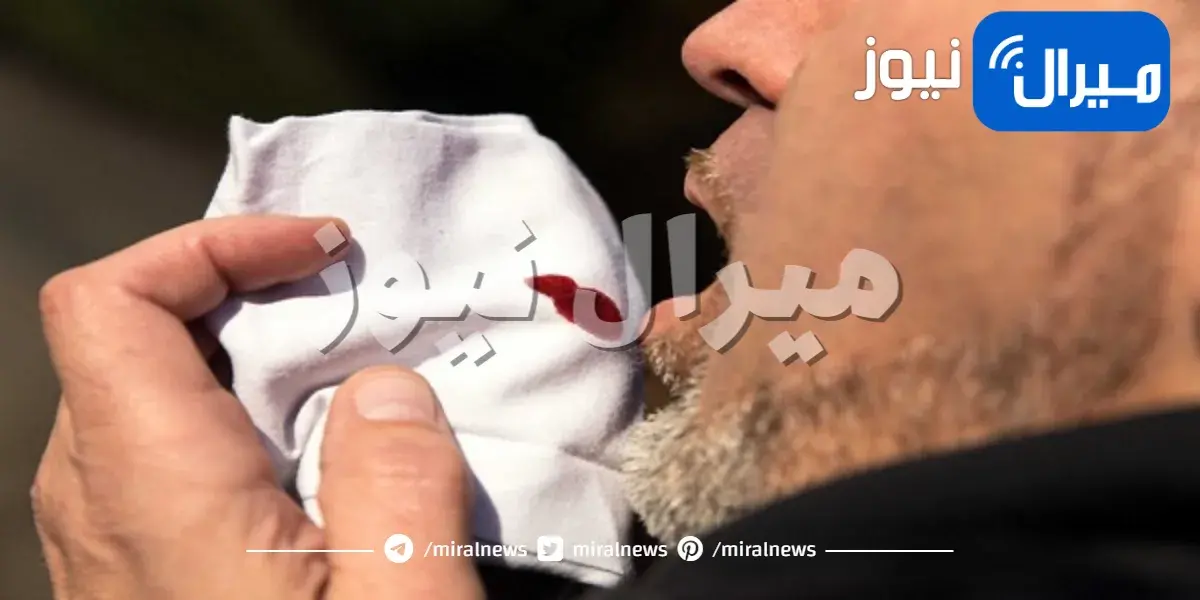 أهم 5 أسباب للسعال الدموي