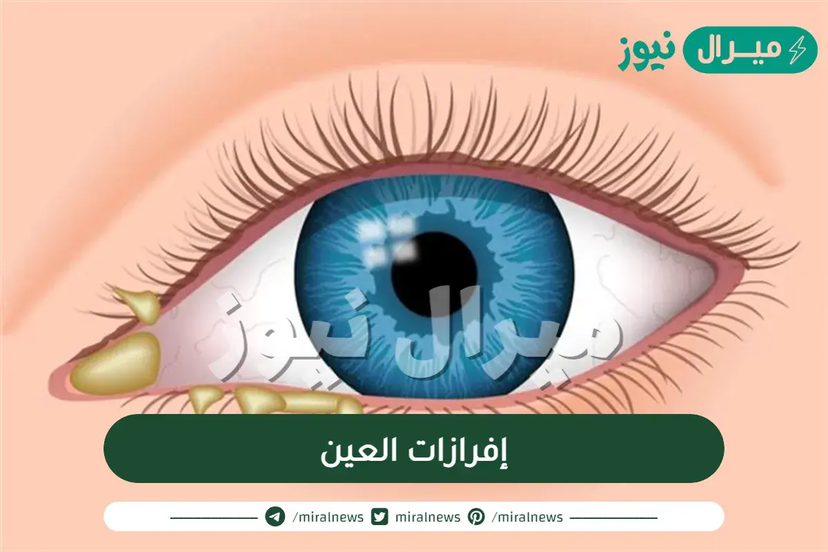 7 أشياء تخبرك بهم إفرازات العين