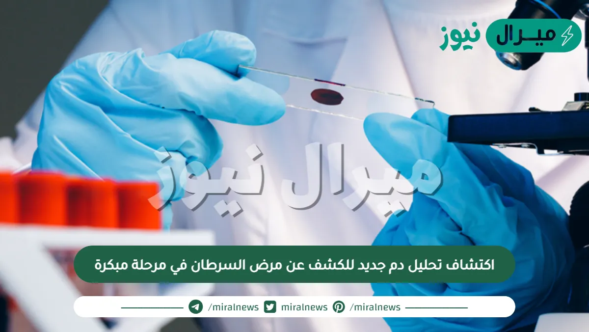 اكتشاف تحليل دم جديد للكشف عن مرض السرطان في مرحلة مبكرة