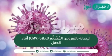 الإصابة بالفيروس المُضَخِّم للخلايا (‏CMV‏) أثناء الحمل‏