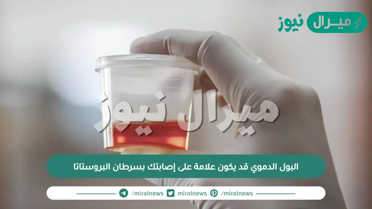 البول الدموي قد يكون علامة على إصابتك بسرطان البروستاتا