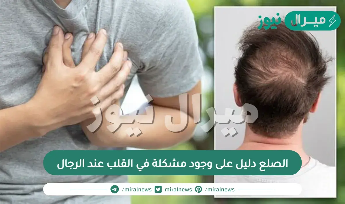 الصلع دليل على وجود مشكلة في القلب عند الرجال