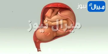 المشيمة الأمامية