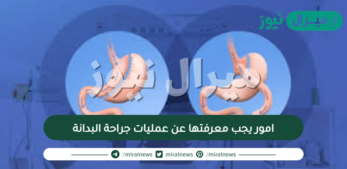 امور يجب معرفتها عن عمليات جراحة البدانة