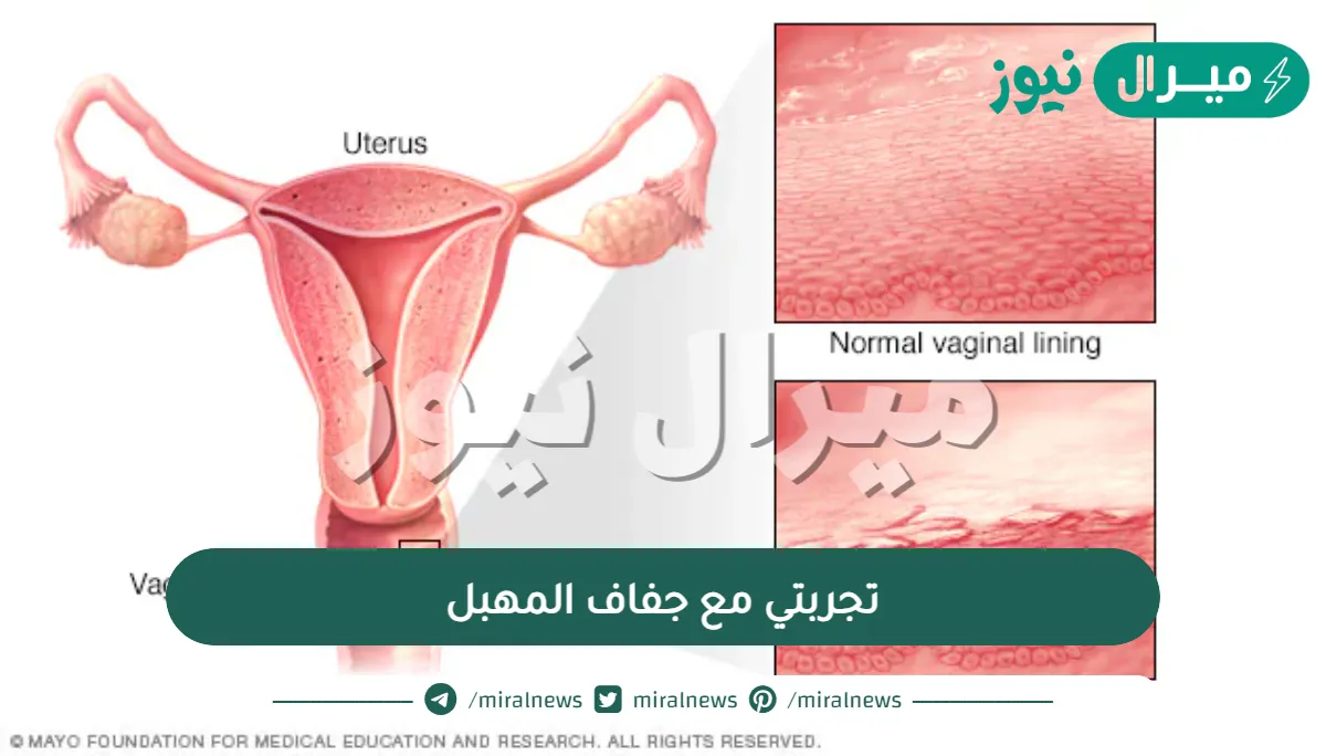 تجربتي مع جفاف المهبل وطرق العلاج