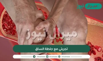 تجربتي مع جلطة الساق وكيفية علاجها