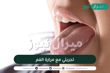 تجربتي مع مرارة الفم