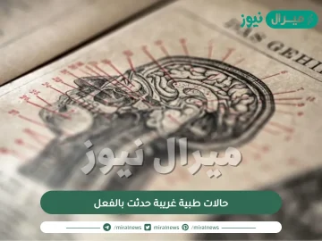 حالات طبية غريبة حدثت بالفعل