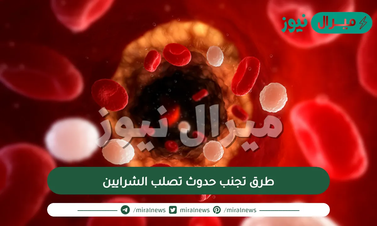 طرق تجنب حدوث تصلب الشرايين