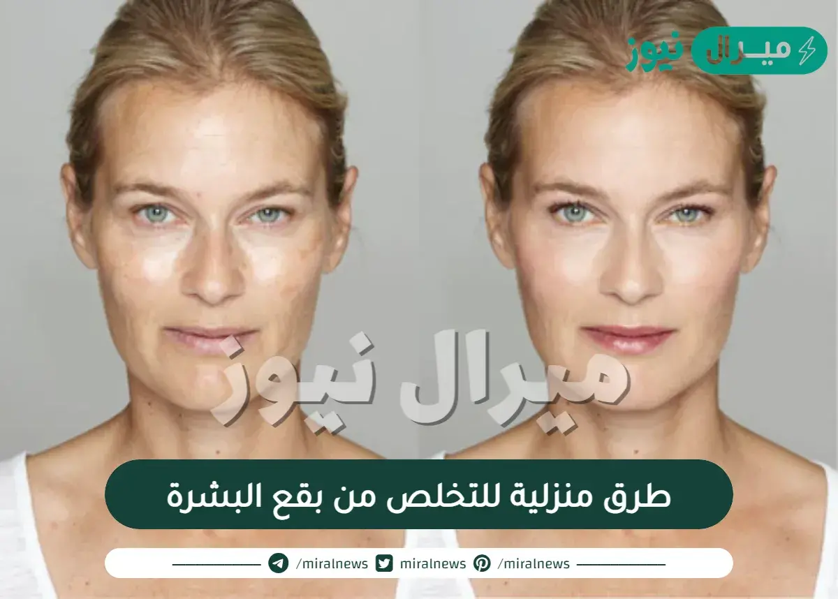 طرق منزلية للتخلص من بقع البشرة
