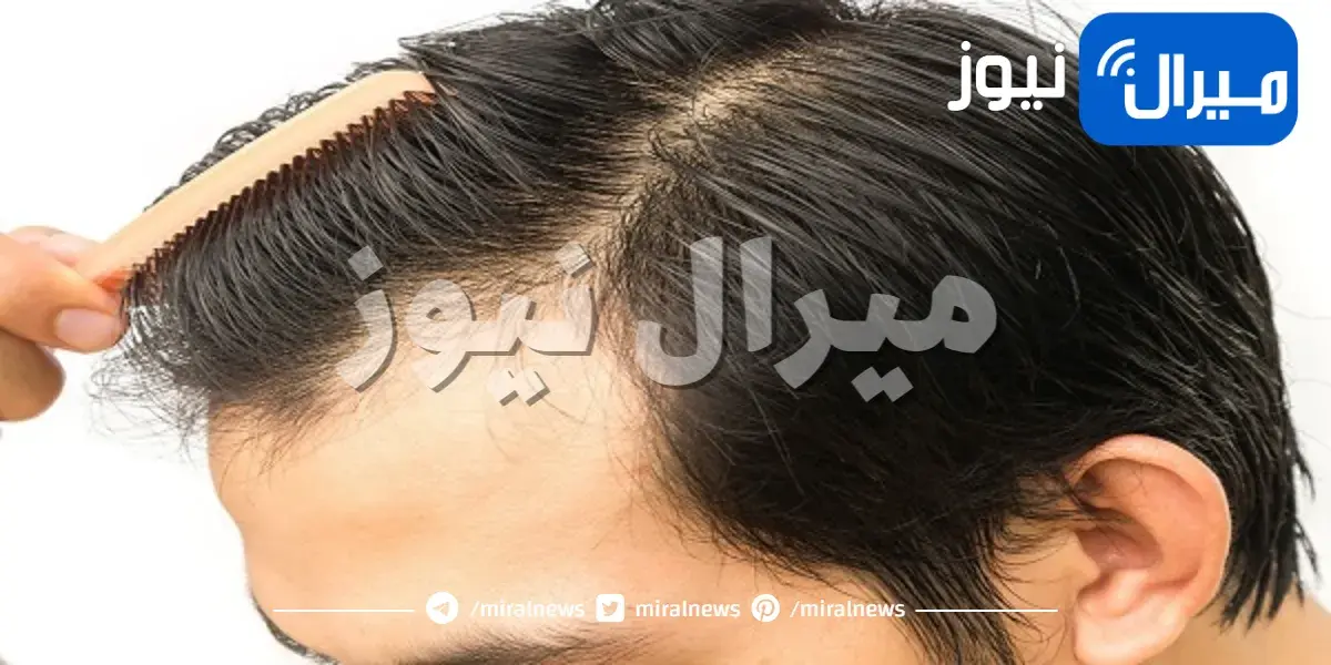 عملية زرع الشعر وأهم مخاطرها