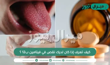 كيف تعرف إذا كان لديك نقص في فيتامين ب12 ؟