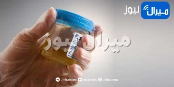 لماذا تحدث التهابات الجهاز البولي ؟.. ومتى تحتاج تدخل جراحي ؟