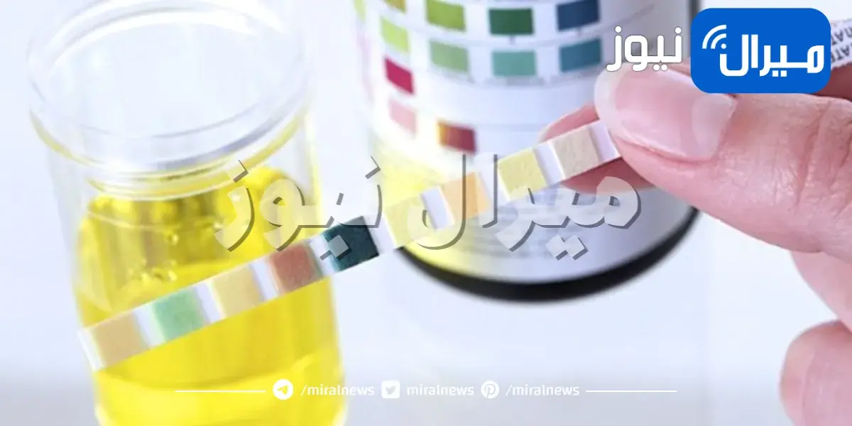 لون البول والبراز مؤشر لحالتك الصحية