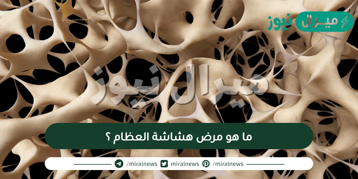 ما هو مرض هشاشة العظام ؟