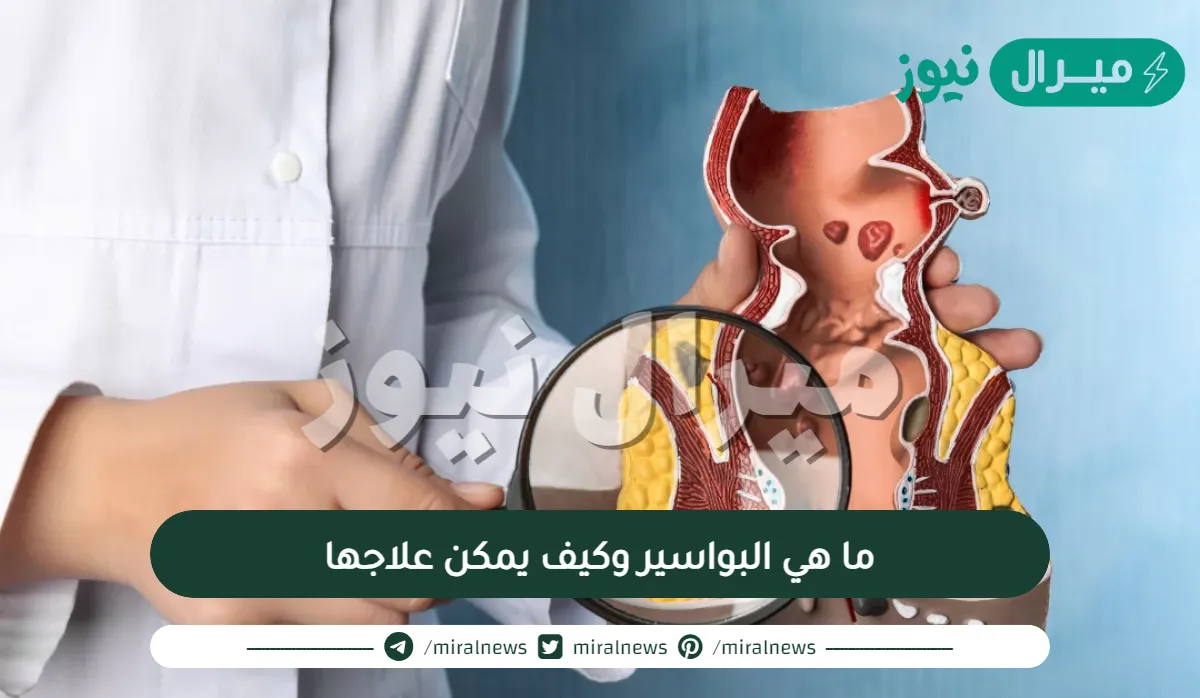ما هي البواسير وكيف يمكن علاجها عند تحولها لحالة مرضية
