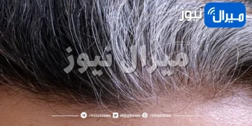 هل هناك علاقة بين الشعر الأبيض والحالة الصحية ؟