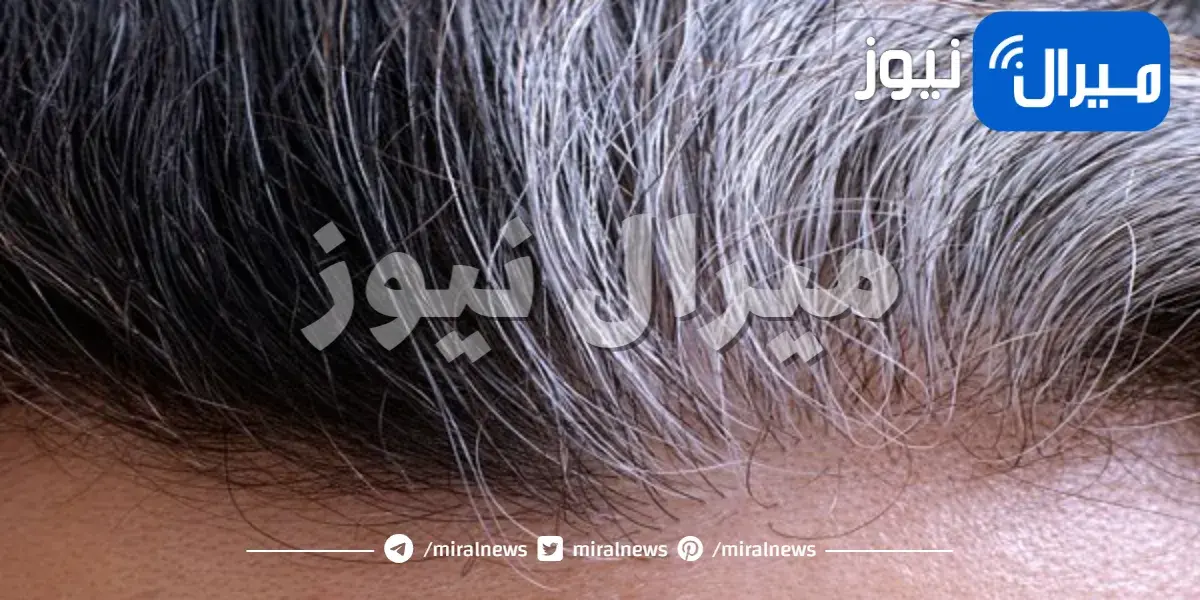 هل هناك علاقة بين الشعر الأبيض والحالة الصحية ؟